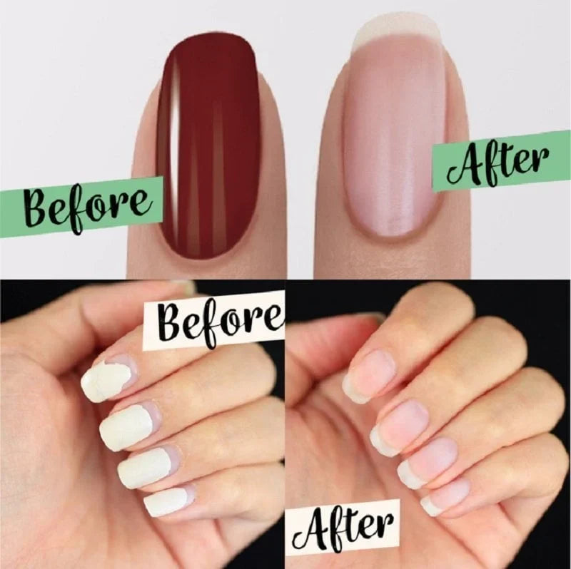 🔥HOT SALE 49% OFF🔥2023 NEW Upgraded Magic Nail Polish Remover