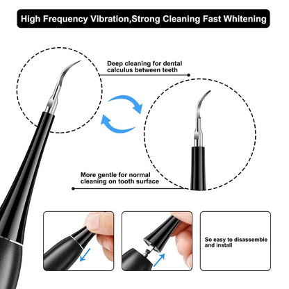 👨‍⚕🦷Electric tooth cleaning instrument -Teeth Cleaner